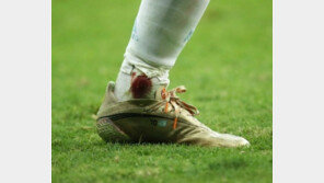 “‘신’ 메시도 사람처럼 피를 흘린다”…피로 물든 메시 스타킹 조명