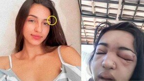 “가족 모두 말렸는데”…눈썹 ‘셀프 피어싱’했다가 사망한 10대 여학생