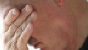 성관계 거부당하자 ‘염산 테러’ 70대男 법정서 “가족 보고싶다”