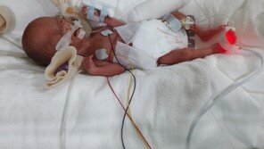 “아들을 저승사자 손에서 되찾아”…540g 미숙아 출생 7개월만에 퇴원