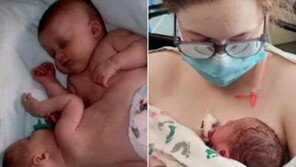 샴쌍둥이로 태어난 여성, 21년 후 분리수술 받은 병원서 딸 출산