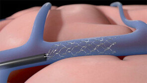 이 작은 칩이 마비환자의 삶을 바꿉니다