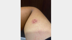 해병대, 후임병에게 시가잭으로 가혹 행위 “엄정하게 처리하겠다”