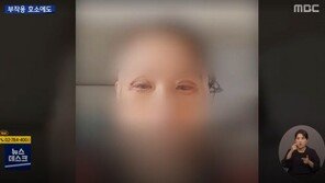 “눈이 반만 떠져”…성형 부작용 호소하던 엄마, 결국 극단 선택