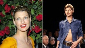 “대중 앞에서 사라진 이유” 신체 기형 고백한 슈퍼모델