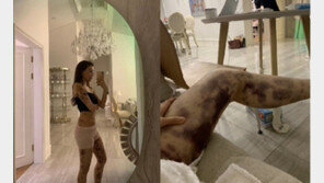 온몸이 피멍으로 뒤덮인 유튜버…“건강주사라 했는데”