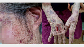 “42kg 치매 할머니 머리채 잡고 ‘질질’…깔고 앉아 집단 폭행” 노인센터 충격