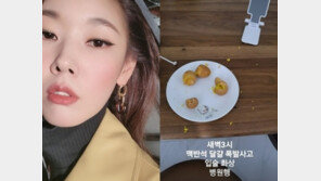 한혜진, 계란 폭발 사고…“새벽3시 병원행”