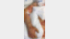 먹다남은 포장음식 먹었을 뿐인데…손가락·두다리 절단