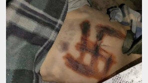 “강간·살해된 여성 배에 卍 문양”…우크라 의원이 공개한 사진