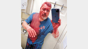 우크라 “러, 돈바스 피란 기차역에 집속탄 공격… 39명 사망” 