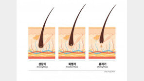 코로나 겪고나니 따라온 탈모… 약용효모로 초기에 관리하자