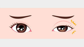 눈 떨림은 마그네슘 부족 탓?…뇌질환 때문일수도