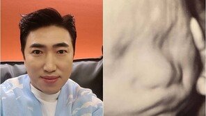 장동민 “딸인데 아빠 닮았다고”…2세 초음파 사진에 걱정