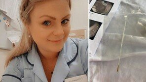 코로나19 검사 중 면봉 통째로 삼킨 英여성…응급 수술받아