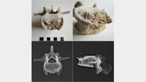 폼페이 화석서 “완전한 DNA” 최초 분석…‘결핵균’ 발견
