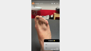 네이마르, SNS에 부어오른 발…손흥민과 대결 무산되나