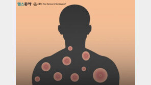 최춘식 “원숭이두창 백신은 자율에 맡길 것…질병청 보고”