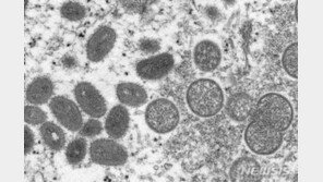 원숭이두창 비상사태 선포되나?…국내 기업도 예의주시