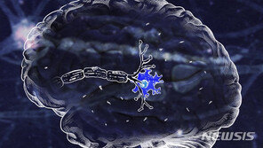 효과 논란 이어 임상 실패…“치매 신약 개발 어렵네”