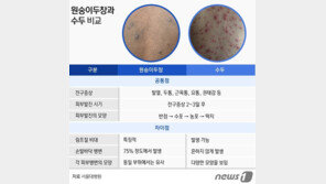 원숭이두창·수두 차이는 ‘림프절 비대’와 ‘손·발바닥 발진’으로 구분