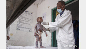 우크라 전쟁 이후 식량 위기 4700만명 늘어…빈곤국 ‘직격탄’