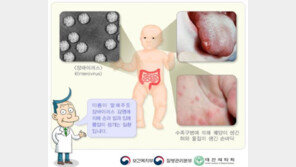 영유아 ‘수족구병’ 환자 급증…작년 10배