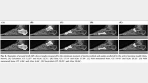 평발 병역 판정 왜 다를까…울산대, 인공지능으로 자동진단