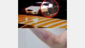 “100만원 갚아” 재촉에…차에 사람 매달고 300m 질주