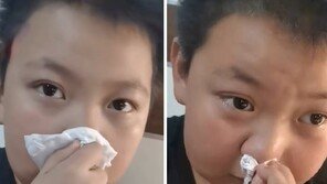 “책냄새 맡으면 눈물 줄줄”…‘숙제 알레르기’ 호소 11세 소년 폭소
