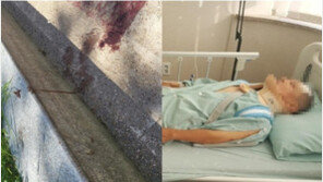 “아버지 하반신 마비 위험”…신도림 킥보드 뺑소니범 잡혔다