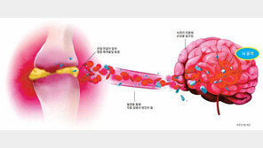 관절 통증이 뇌 건강 위협… 방치하면 치매 위험 높아진다