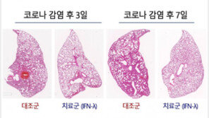 서울대병원 연구팀, 코로나·폐렴 완화하는 흡입형 치료제 개발 길 열어