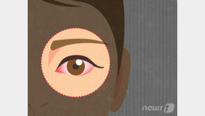 젊은층도 백내장 조심…“당뇨병·자외선 노출·흡연 등 연관”