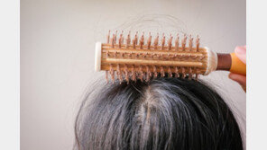 “탈모는 아버지 탓? 모계 유전이 더 강하다”