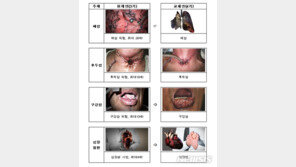 담뱃갑 경고그림·문구, 내일부터 변경…“더 끔찍해진다”