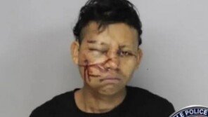 ‘나홀로 집에’ 실사판…성탄절 강도, 빙판 나뒹굴어 얼굴 만신창이