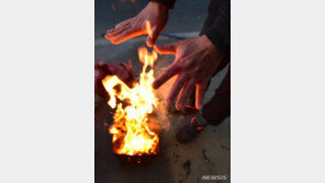 “추워도 너무 춥다”…동상 증상땐 비비지 말고 병원으로