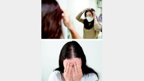 탈모증상 따라 치료법 제각각… 올바른 유형 파악이 먼저 