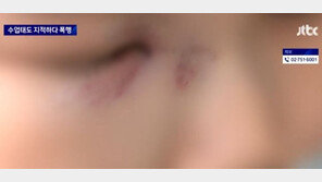 “욱해서 한대 때려” 중학생 코뼈 부러뜨린 학원 강사