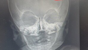 생후 13일 아기 떨어뜨려 뇌출혈…산후조리원 원장 등 3명 송치 