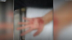 중고생 14명이 여중생 1명 집단폭행…노래 틀고 때리며 조롱