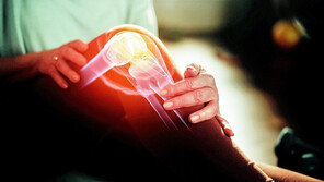 손상되면 재생 힘든 연골… 무리한 운동 피하고 ‘콘드로이친’ 섭취를