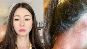 이소라, 충격적 목덜이 상태…“좋다고 난리난 샴푸 썼다가 이 고생”