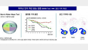 난치성 뇌 질환 치료제, 저분자 약물로 글로벌 시장 진출 기대