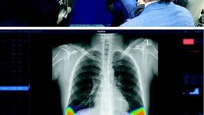 10여 년간 지지부진하던 의료 AI… 영상판독 역할 맡으며 전환점 모색