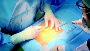 “척추 수술환자 10년 추적했더니… 반강성고정술 효과 가장 좋아”