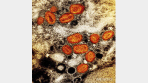 대만서 원숭이두창 환자 4명 다시 발병…누계 16명로 늘어