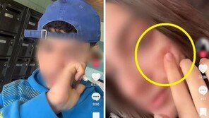 틱톡 ‘얼굴에 흉터 내기’ 유행에 이탈리아 당국, 조사착수