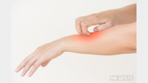 “불규칙 식습관에 스트레스까지”…성인 아토피 주의보